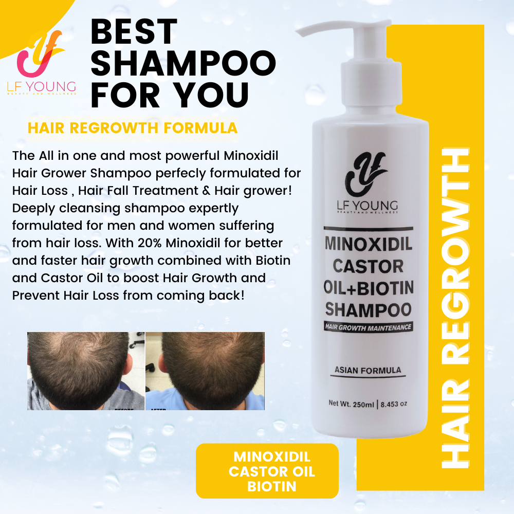 [BUNDLE] Shampoo + Solution Minoxidil Hairgrower Shampoo 250mL for Hair Loss Treatment by LF Young