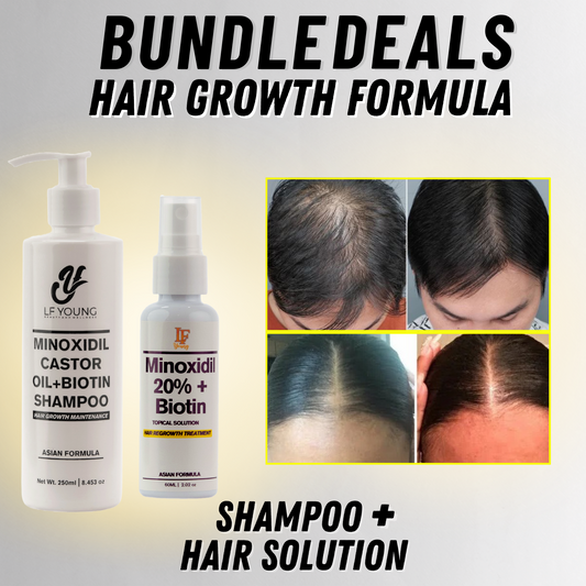 [BUNDLE] Shampoo + Solution Minoxidil Hairgrower Shampoo 250mL for Hair Loss Treatment by LF Young