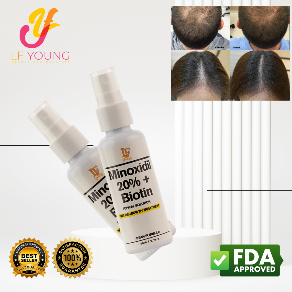 [BUNDLE] Shampoo + Solution Minoxidil Hairgrower Shampoo 250mL for Hair Loss Treatment by LF Young