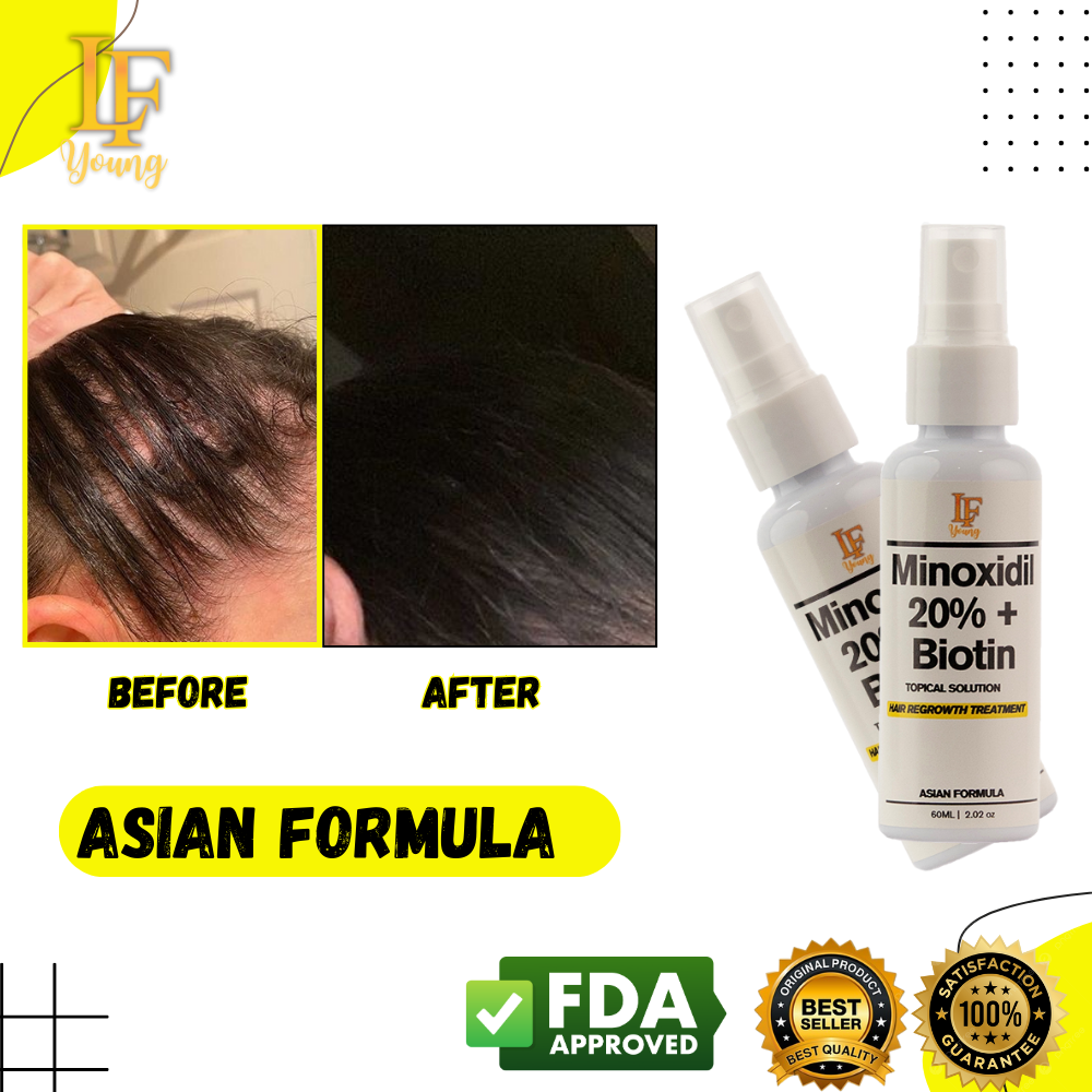 [BUNDLE] Shampoo + Solution Minoxidil Hairgrower Shampoo 250mL for Hair Loss Treatment by LF Young