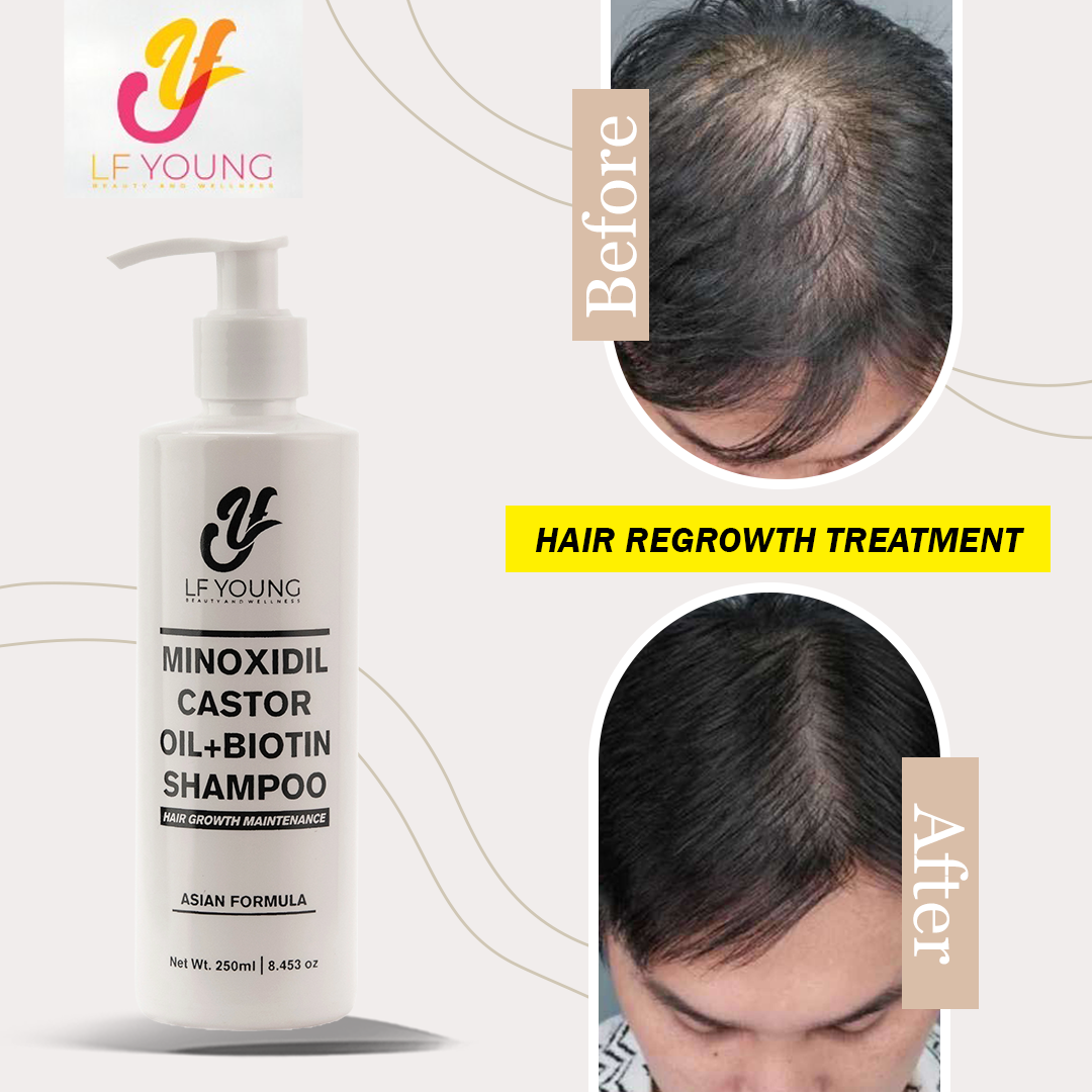 Minoxidil Hair Grower Shampoo with Biotin and Castor Oil 250mL for Hair Loss Treatment by LF Young